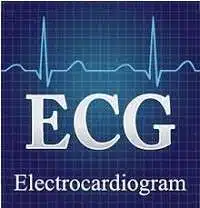 ECG Full-Form | What is Electro Cardio Gram (ECG)