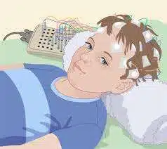 EEG Full Form in English | Meaning of EEG 1 EEG Full-Form | What is Electroencephalogram (EEG)