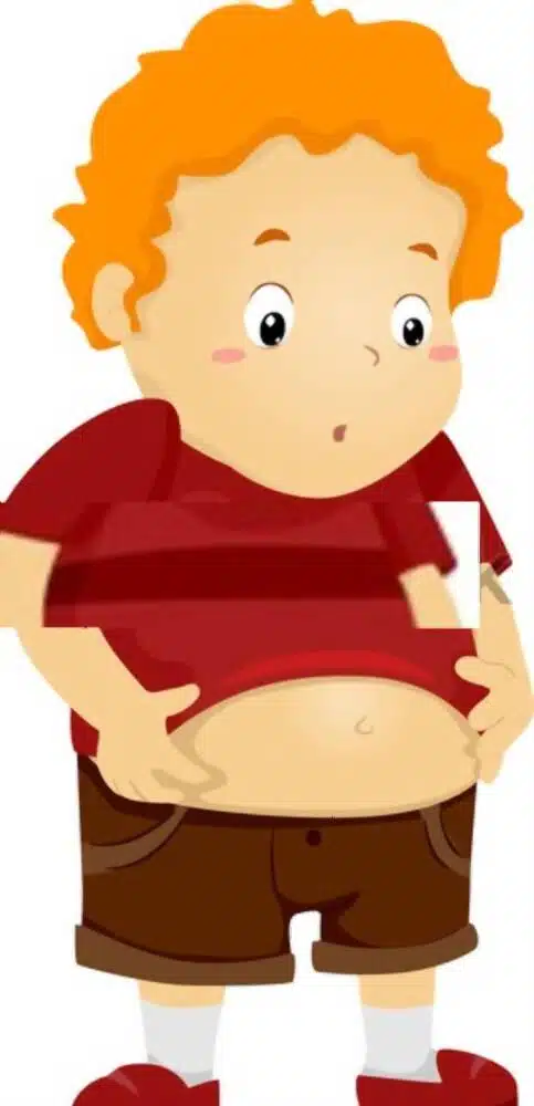 Childhood Obesity Meaning edumantra.net